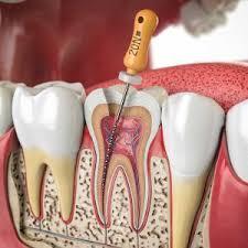 General and aesthetic dentistry - veneers, whitening and restorative care